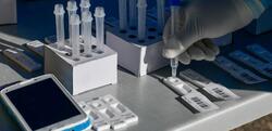 Πανελλήνιος Ιατρικός Σύλλογος / Λέει όχι στη μείωση στην τιμή των PCR και συνιστά να αναλάβει το κόστος η Πολιτεία