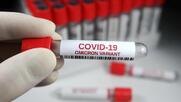 Η νέα πραγματικότητα της covid-19
