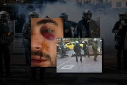 Τα ΜΑΤ τον εγκατέλειψαν αναίσθητο, πεταμένο στα αίματά του – «Νόμισαν πως με σκότωσαν»