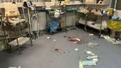 Σοκ στα δημόσια νοσοκομεία: «Δουλεύουμε με ακατάλληλα υλικά λόγω κόστους»