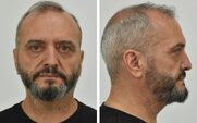 Κολωνός: Αναμένεται ένταλμα σύλληψης της συζύγου του Μίχου για χρηματισμό και υπόθαλψη