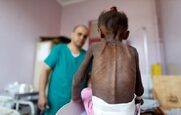 Καμπανάκι για 14 εκατομμύρια ανθρώπους που απειλούνται με λιμοκτονία στην Υεμένη