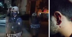 Καταγγελία για ρεσιτάλ αστυνομικής βίας στην Πάτρα: «Να βάλουμε σε lockdown την πολιτική τους και όχι τις ζωές μας»