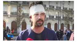 Σύνταγμα: Ο φοιτητής που τραυματίστηκε είπε στον «αέρα»: «Μην το “κόψετε”, τραυματίστηκα με γκλοπ αστυνομίας»