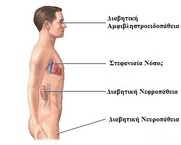 «Σχετικά με την ιατροφαρμακευτική κάλυψη χιλιάδων διαβητικών στη χώρα μας». 